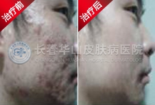 长春华山医院给我找回面子