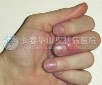 201011151333151110.jpg