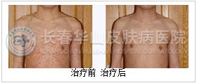 ݡǰԱ